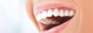 Chipped Tooth