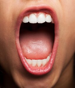 tongue Remedies