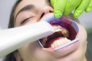 dentist scanning patients teeth with iTero scanner