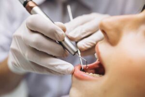 dentist checking for periodontal disease